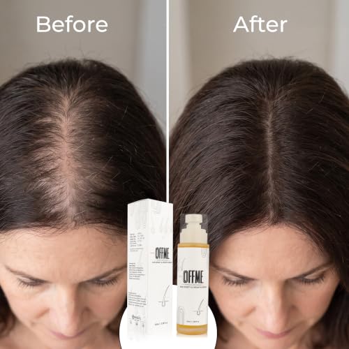 OFFME Hair Density & Hair Growth Serum | With Rosemary, Procapil, Redensyl, Pumpkin Seed Extract, Amla Extract, Bhringraj Extract | Reduces Hair fall | Grows New Hair | For Men & Women, 100ml - Image 7