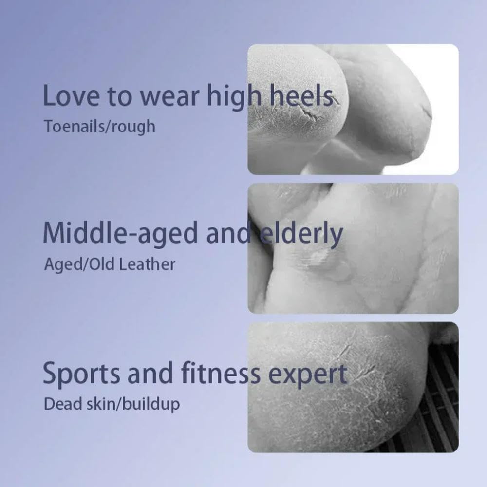 Pedicure Elettrico Lima per Piedi Dispositivo di Bellezza per Piedi Impermeabile Macchina per Pedicure Ricaricabile Rimuove la Pelle Morta e i Calli del Corpo