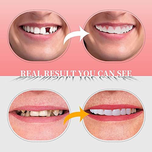 Fake Teeth, 2 Pcs Veneers Dentures Socket For Women And Men, Dental Veneers For Temporary Tooth Repair Upper And Lower Jaw, Protect Your Teeth And Regain Confident Smile, Bright White 2Pcs #TOP6