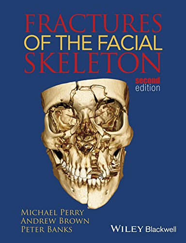 Fractures of the Facial Skeleton eBook : Perry, Michael, Brown, Andrew