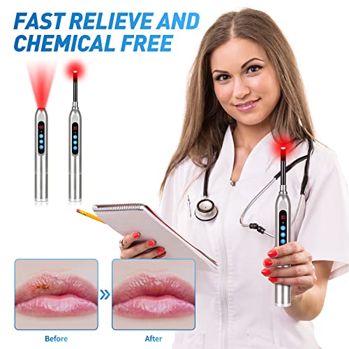 Yipfree Red Light Therapy Device, Cold Sore Canker Sore Treatment Device, Infrared Light Therapy For Lips Mouth Nose Ear Knee Feet Hands Joint Muscle Nerve Pain Relief With Removable Tip #TOP3