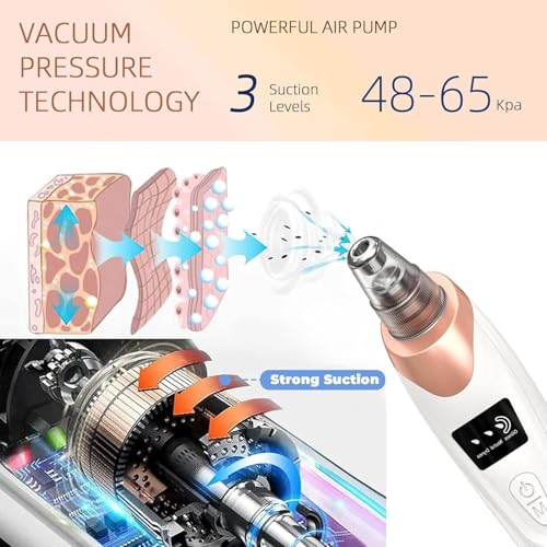 Image of 5 in 1 Multi-Function Blackhead Whitehead Remover Device, Skin Cleaner, Pimple Removal Tool, Acne Pimple Cleaner Vacuum Suction for Men and Women (5 in 1 Plus Blackhead) (white)