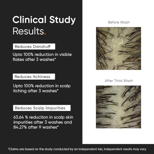 Image of Minimalist Anti-Dandruff Shampoo | 2% Salicylic Acid, Climbazole & Piroctone Olamine | Reduces Flakes & Itchy Scalp | Sulphate-Free | Fragrance-Free | 20 ml