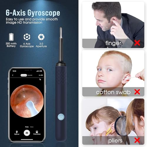 Image of Ear Wax Removal - Earwax Remover Tool with 7 Pcs Ear Set - Ear Cleaner with Camera - Earwax Removal Kit with Light - Ear Camera with 4 Ear Spoon - Ear Cleaner for iOS & Android