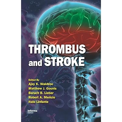 Thrombus and Stroke