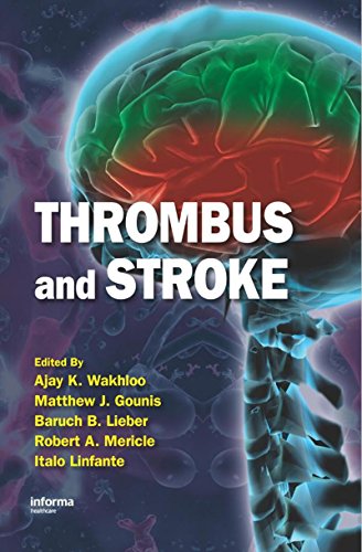 Thrombus and Stroke (Neurological Disease and Therapy) (English Edition) - Wakhloo, Ajay K.