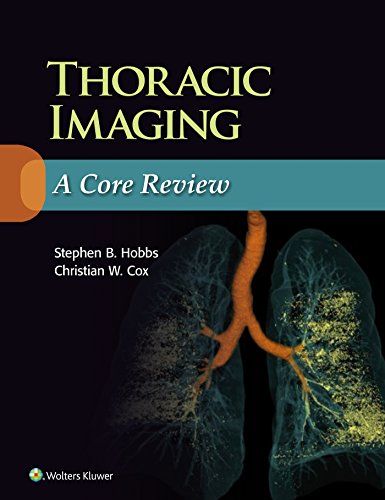 Thoracic Imaging: A Core Review