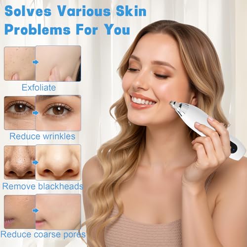 Yofuly Cordless Dermabrasion Facial Machine