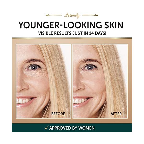 Anti-Aging-Night-Cream-Facial-Skin-Care-Product-Collagen-Cream-Retinol-Cream-for-Face-Face-Moisturizer-for-Face-Tightening-and-Lifting-Cream-Firming-Cream Anti-Aging Night Cream - Facial Skin Care Product - Collagen Cream & Retinol Cream for Face - Face Moisturizer for Face - Tightening and Lifting Cream - Firming Cream