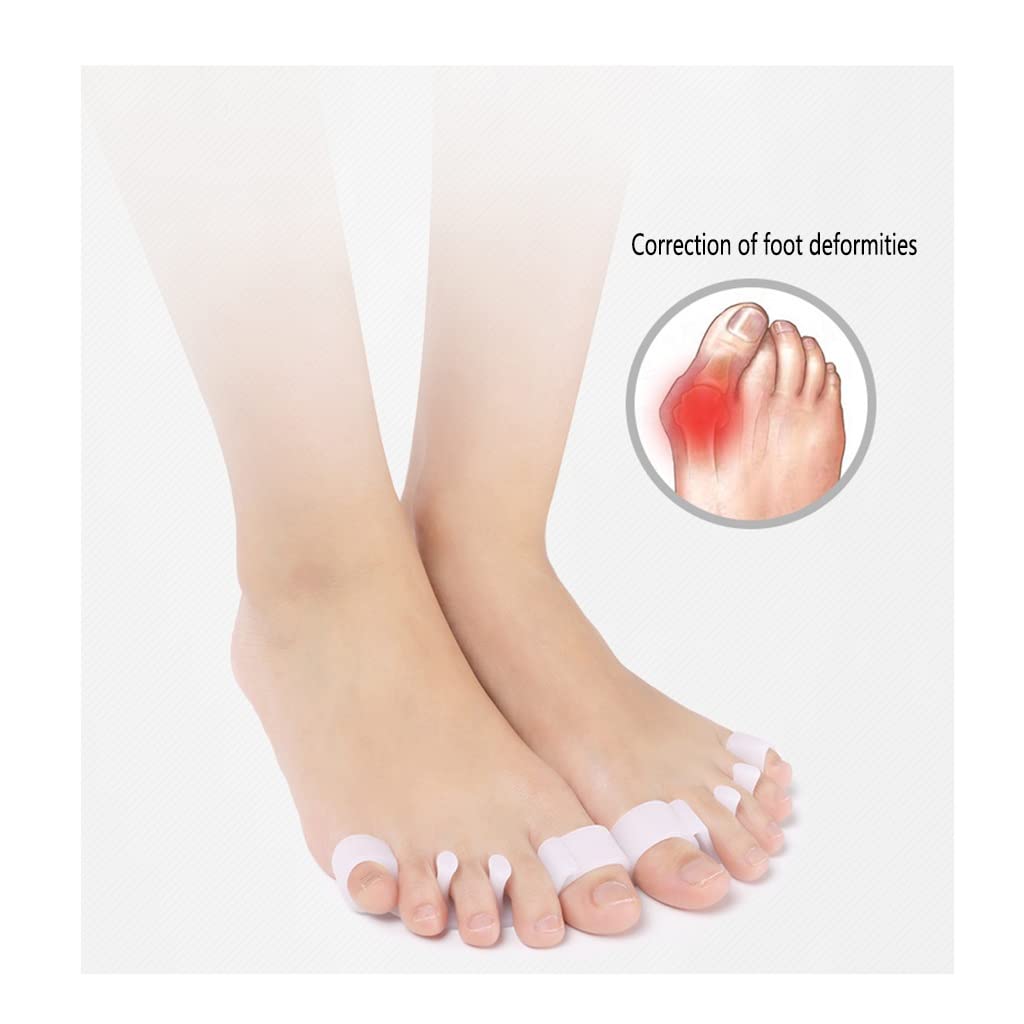 Separadores de Dedos de los pies, Dedos superpuestos, Martillo y juanete, Alivio del Dolor en el pie, Hombres y Mujeres, alisador de Hallux Valgus, Yoga, Correr correctamente