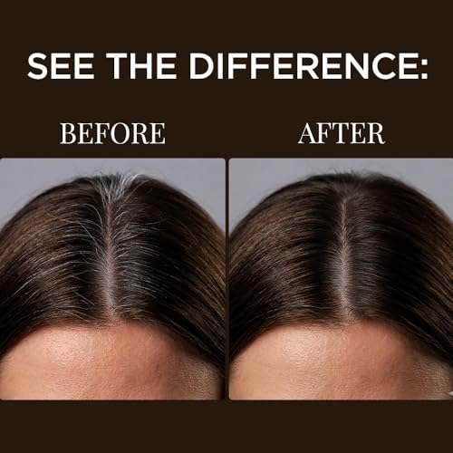 Image of BELLAVITA Brown Spell Hair Powder | Instant Grey Coverage & Thinning Spot Concealer | Smudge-Proof, Sweat-Resistant & Long-Lasting Formula | Natural looking colour | 4g