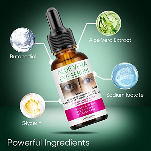 Aloe Vera Eye Serum Dark Circles Under Eye Treatment For Women To Reduce Appearance Of Puffy Eyes Eye Bags Fine Lines And Wrinkles For All Skin Types #TOP5