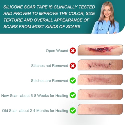 image for SLUKHIG Silicone Scar Sheets (1.6