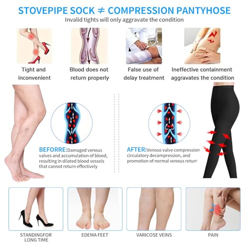 Image of Medical Compression Pantyhose for Women Support Stockings 20-30 mmHg Treatment Swelling, Edema Varicose Veins