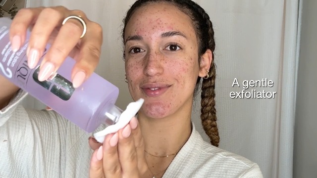 Amazon.com: Clinique 3-Step Clarifying Lotion Face Exfoliator 1