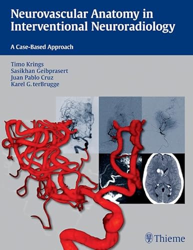 Neurovascular Anatomy in Interventional Neuroradiology: A Case-Based Approach