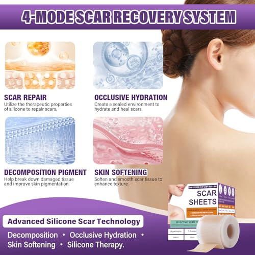 Image of Silicone Scar Sheets, Medical Grade Silicone Scar Tape for Surgical, Hypertrophic, Keloid, C-Section, Burn, Old & New Scars, Reusable Professional Scars Removal Sheets (1.6 inchX 157 inch Roll-4M)