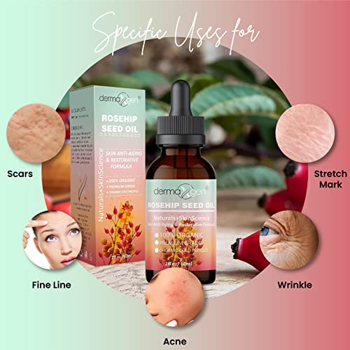 Dermaxgen Rosehip Seed Oil 2 Fl Oz -100% Organic & Cold Pressed - Anti-Aging Moisturizing Treatment For Face, Hair, Skin & Nails, Acne Scars, Anti-Wrinkle. #TOP5