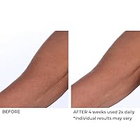 Vista 7 de NassifMD Inhibidor de Crepe Triple Acción, 8 Fl Oz