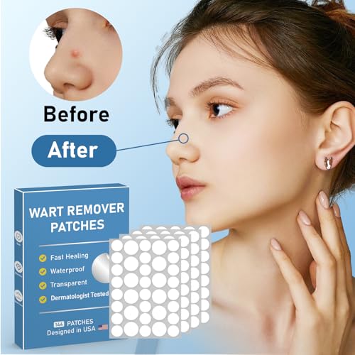 Image of Wart Remover - Salicylic Acid Patches for Common and Plantar Warts - Waterproof & Adhesive Pads - Invisible Hydrocolloid Protection for Feet & Fingers (144 Patches) - M20