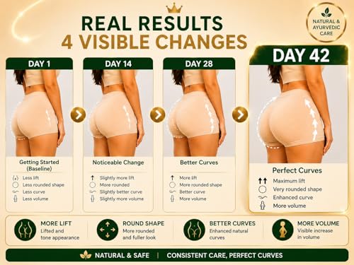 Image of Velna curvex ayurvedic herbal capsules for hips growth (pack of 3)