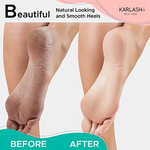 Karlash KAR15954-P Professional Pedicure Foot Pumice Stone thumb #3