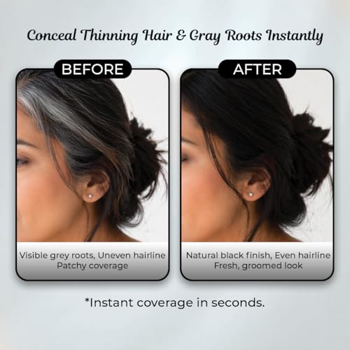 Image of Sanfe Quick Fix Hair & Eyebrow Touch-Up Kit | Powder Stick For Thinning Hair, Bald Spots & Root | Hairline Contouring | Waterproof | Gray & Thin Hair For Women & Men