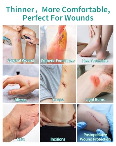 Upadated Hydrocolloid Bandages,12FT Hydrocolloid Roll for Wound Care,Medical-Grade Hydrocolloid Patch Bandages with Self-Adhesive, Flexible & Waterproof DIY Size & Shape (2in*12ft)
