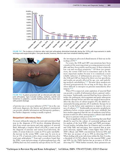 Techniques In Revision Hip And Knee Arthroplasty #TOP4