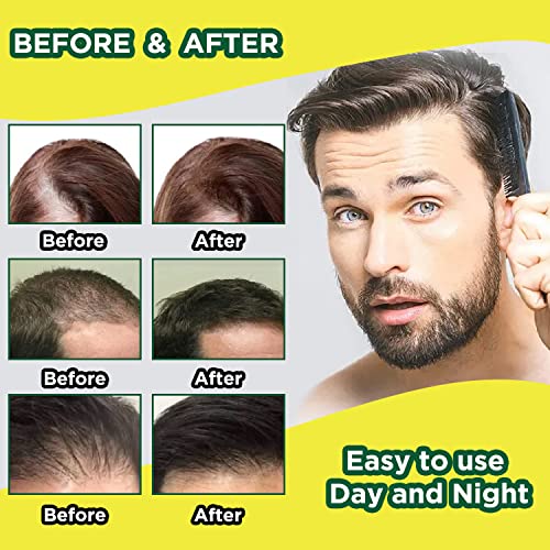 3Xpcs 7 Days Ginger Hair Growth Spray Serum Anti Hair Loss Products Fast Grow Prevent Hair Oil Dry Damaged Thinning Repair Care,Serum Grow Loss Treatment Dense 30Ml [Us Stock] #TOP6