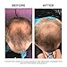 PHYTO Phytophanère 100% Natural Hair Loss Thinning Dietary Supplement, 2-Month Supply 120 Count (Pack of 1)
