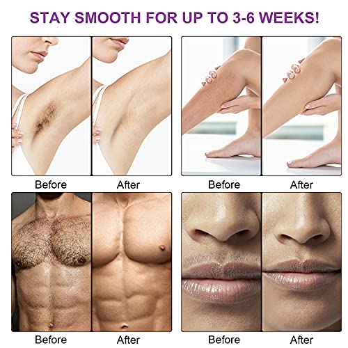 Nyandu BX-WAX Waxing Kit For Women Men, Nyandu Wax Warmer For Hair Removal, 17.6 Oz Wax Beads (5 Packs), Hard Wax Kit For Coarse Hair Facial Eyebrow Legs Armpit Bikini Brazilian, Professional Home Wax Machine thumb #3