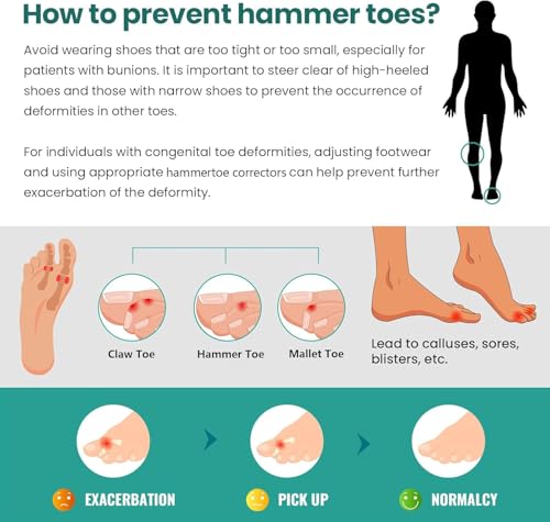 Image of Welnove Hammertoe Corrector - 6 Pack Toe Splints - Soft Gel Toe Straighteners - Realign Bent, Curled, Crooked, Claw, Hammer Toes, 3 Different Sizes (Green)