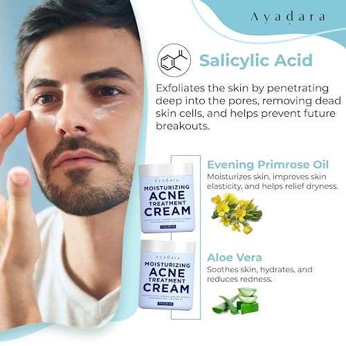 Ayadara Breakout Warrior Acne Cream, 90-Day Supply, Acne Moisturizer For Face And Body, Salicylic Acid Acne Treatment, Acne Facial Moisturizer For Oily, Blackhead, Whitehead, For All Types Of Skin #TOP5