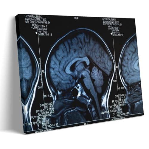 MRI Scan Poster of Human Brain And Skull Wall Art Paintings Canvas Wall Decor Home Decor Living Room Decor Aesthetic 12x18inch(30x45cm) Frame-style