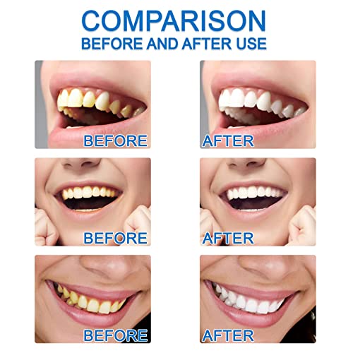 Dazzlewhite Teeth Whitening Essence, Teeth Whitening Essence Extra Strong White Hygiene Tooth, Teeth Stain Remover To Whiten Teeth, Intensive Stain Removal Teeth Reduce Yellowing (2Pcs) #TOP4