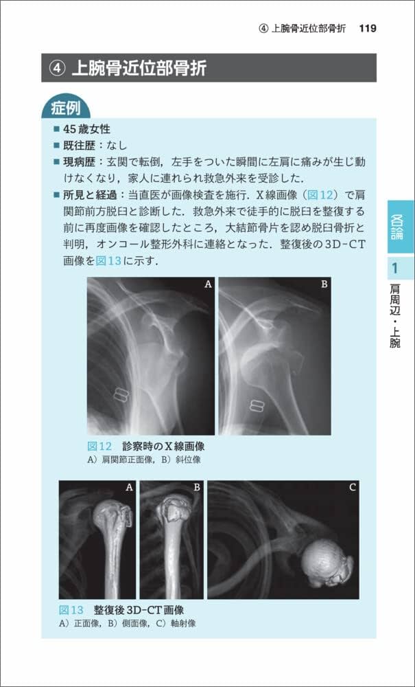 救急・当直必携! 頼れる整形外傷ポケットマニュアル〜症例で学ぶ