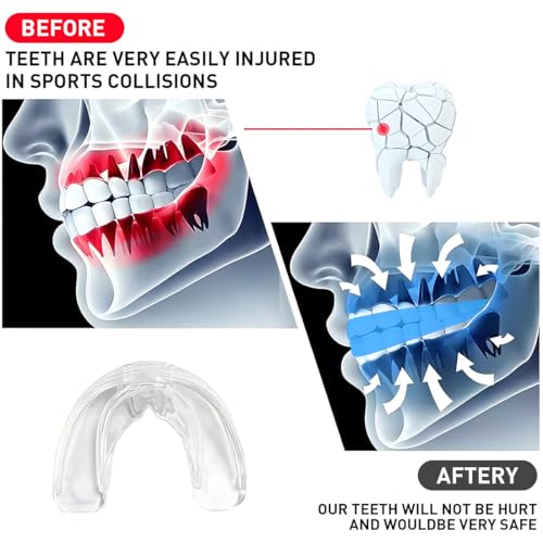 TEOZBLU 3 Stück Sport Mundschutz, Sport Zahnschutz, für Rugby, Boxen, Kampfsport, Hockey, MMA, Taekwondo und Mehr, Erwachsene