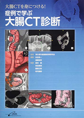 キンドル 無料電子書籍 症例で学ぶ大腸CT診断 バイ
