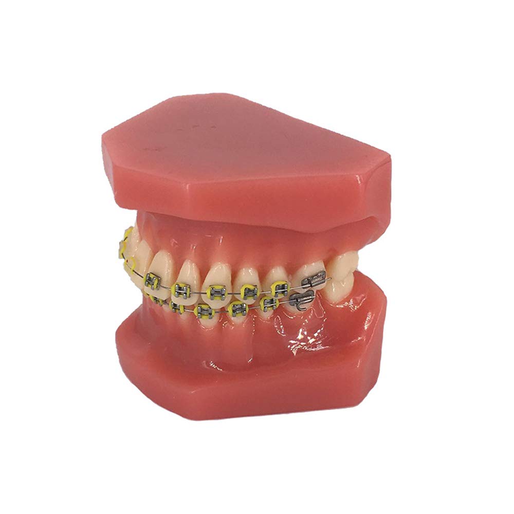 Model ortodontyczny zębów zębów z metalowymi i ceramicznymi modelem doustnym dla dentysty do komunikowania się z pacjentami, studiowanie narzędzia dydaktycznego
