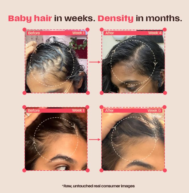 Image of Days Ahead Leave-In Hair Growth Serum | Redensyl, Anagain, Caffeine & Ceramide | Promotes New Hair Growth | Advanced Anti Hair Fall Treatment | Non-Sticky, Oil-Control Formula |For Both Women & Men