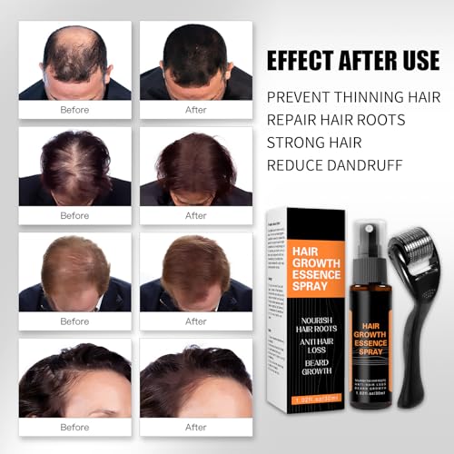 Spray para el Crecimiento del Cabello, Spray Anticaida de Cabello y Crece Pelo, Sérum Para Crecimiento del Cabello Tratamiento para el Crecimiento, Nutrir los Folículo Piloso para Mujeres y Hombres - imagen 6