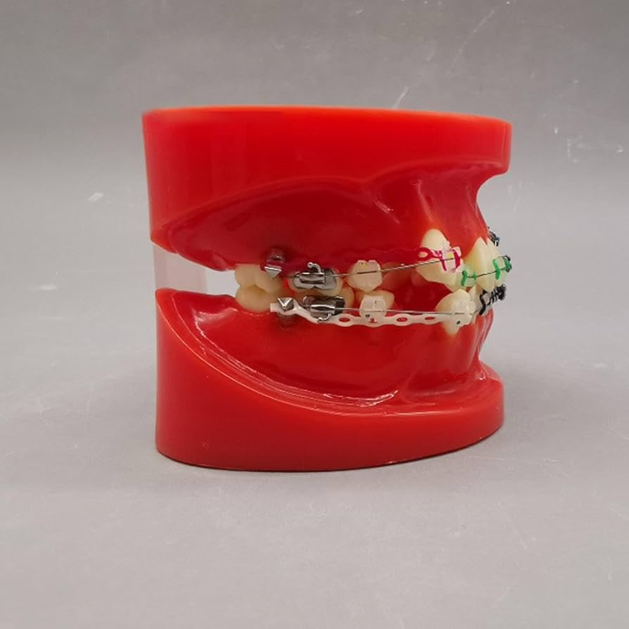 歯科矯正学 永末書店 歯科矯正学エッセンシャルテキスト