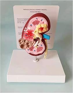 Canine Anatomical Dog Kidney Model - Animal Organ Anatomy Model Dog Kidney Diseased and Healthy Anatomical Model - for Canine Pet Teaching Aid Veterinary Medicine Model