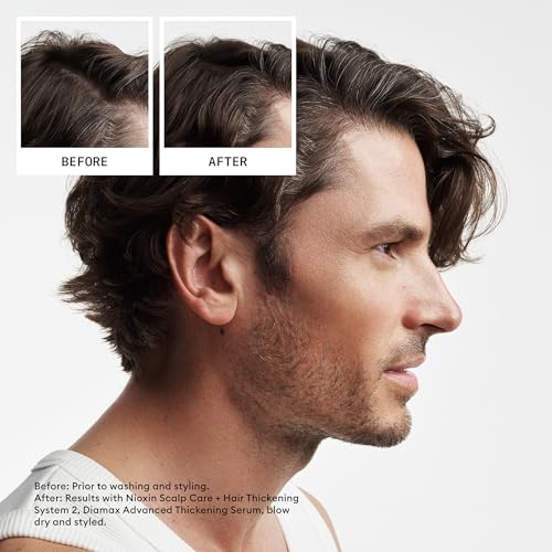 image for Nioxin Scalp + Hair Thickening System 2 Conditioner, For Natural Hair 