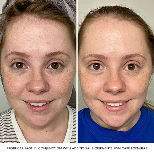 Bioelements Beyond Hydration - 2.5 Fl Oz - Non-Greasy Gel Facial Moisturizer For Oily Skin - Includes Vitamin B5 & Essential Oils - Vegan, Gluten Free - Never Tested On Animals #TOP3