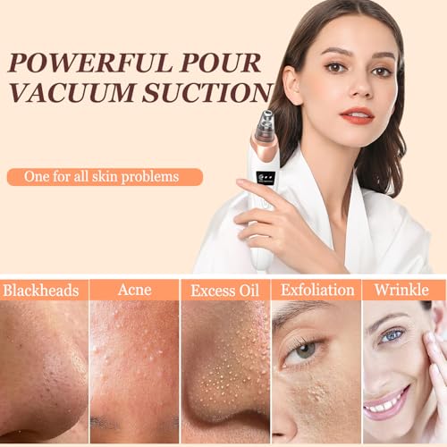 Blackhead Remover Vacuum 3 Suction Power Mode Blackhead Remover Tool with 5 Suction Heads Blackhead Extractor Rechargeable Comedone Extractor,Pore Vacuum Whitehead Remover Suitable for Women and Men - Image 4