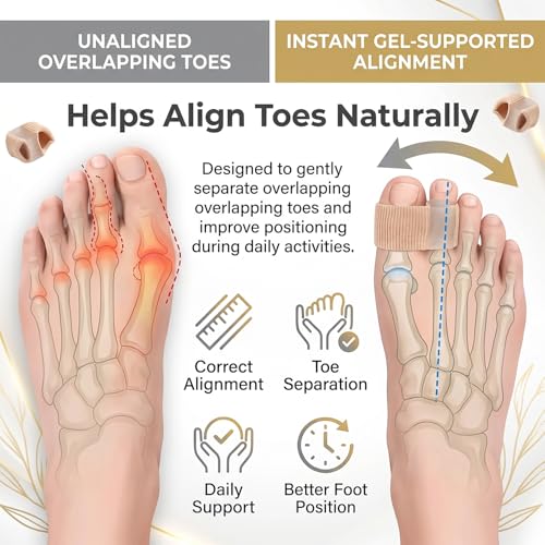 Image of Bunion Corrector & Toe Separators for Men and Women - Dual Size (S+L) Gel Toe Straightener with 2 Loops for Overlapping Toes, Hammer Toe & Hallux Valgus Pain Relief (Pack of 2)