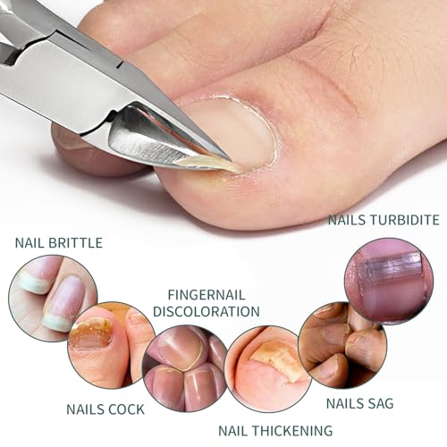 Schräge Nagelknipser Fußnägel, Breiter Nagelknipser aus Edelstahl mit Schrägschneide, Präziser Fußnagelknipser für dicke Nägel, Rutschfester Griff, Anti-Spritz Design