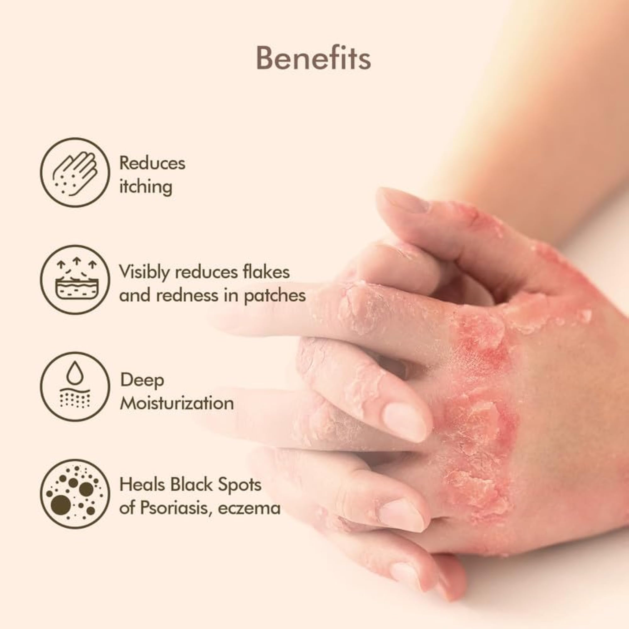 Natural Psoriasis Oil, 2-in-1 Relief